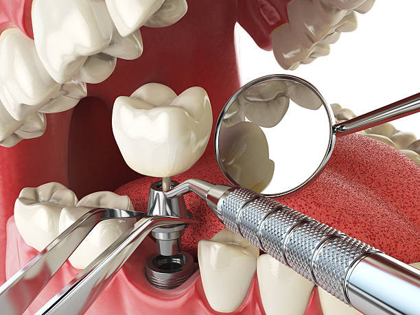 Best Emergency Denture Repair in Crowley, LA